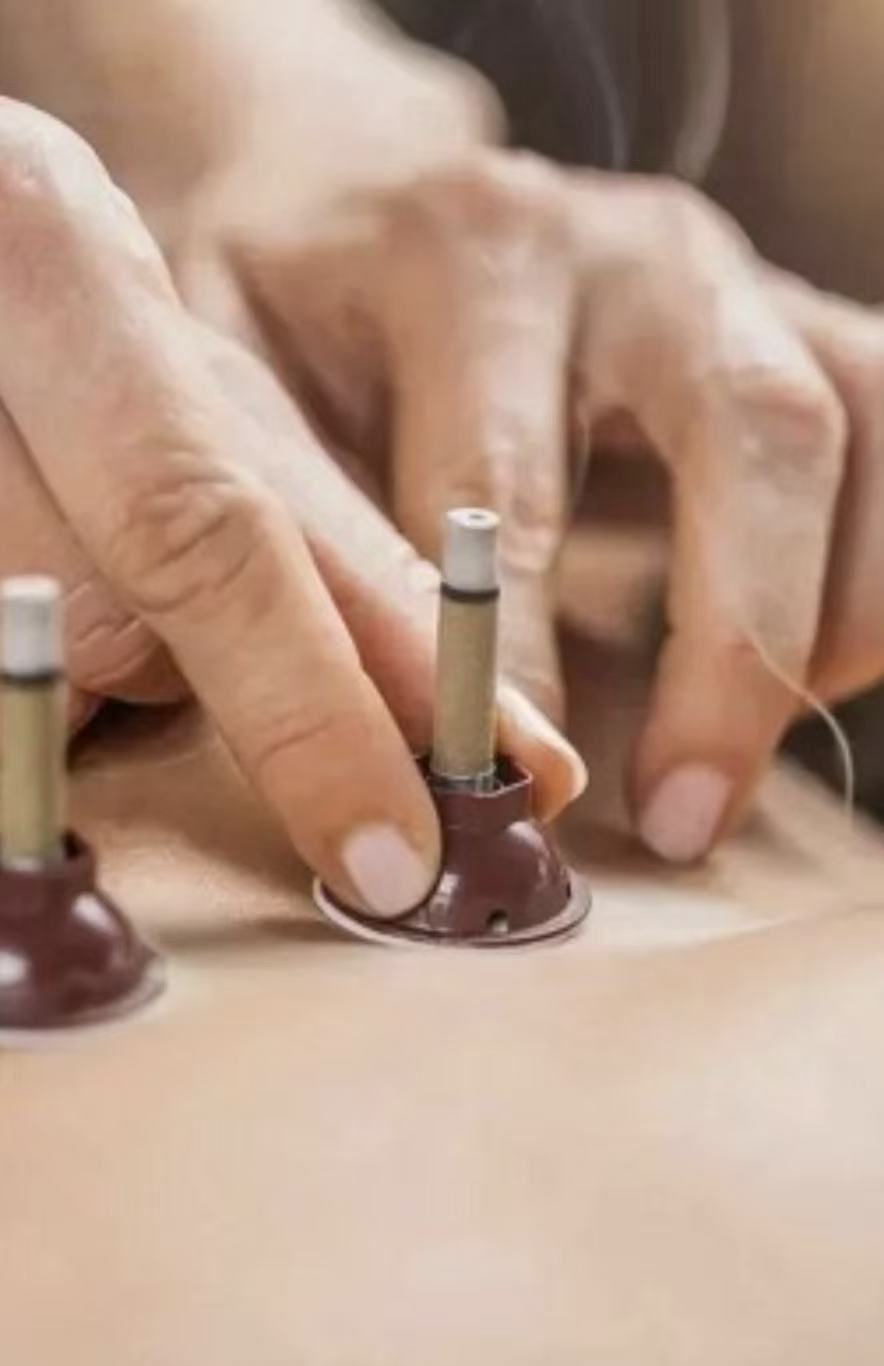 Moxibustion